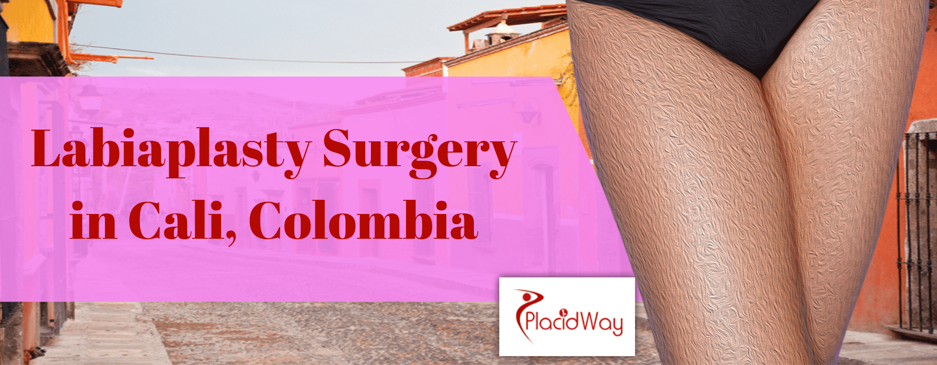 Labiaplasty Surgery Packages in Cali, Colombia